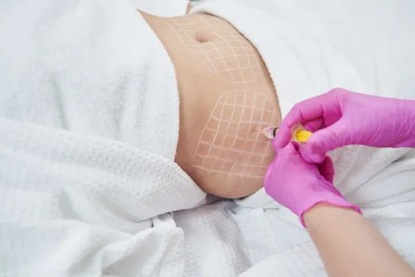image of fat dissolving injections on love handles to help combat weight gain Midlands
