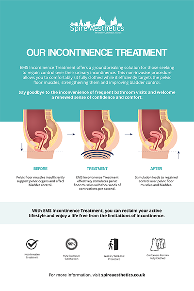 image of how urge incontinence Midlands treatment works