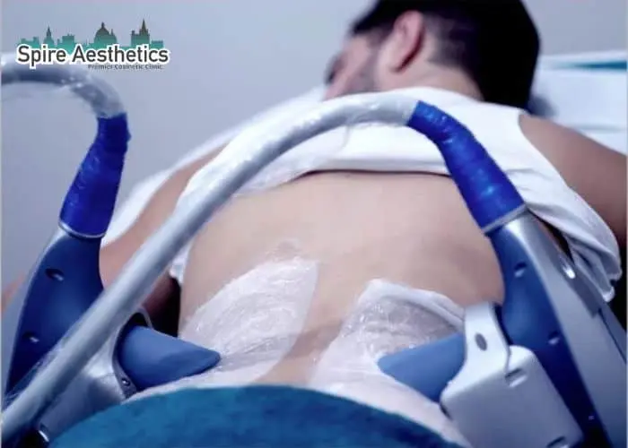 Man having fat freezing treatment done on love handles before a competitions Midlands to create a sculpted look.