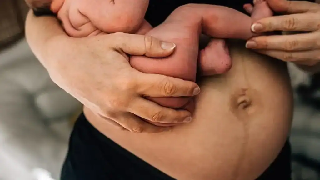 Why Is My Stomach Still Big After Pregnancy Midlands ?